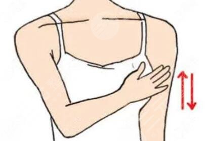 胸部下垂提升