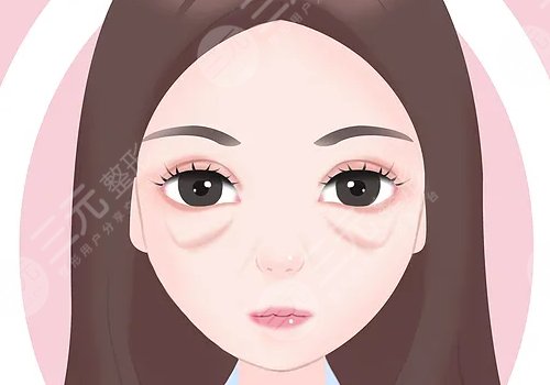 汕頭市中心醫(yī)院整形去眼袋多少錢