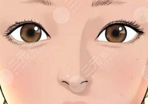 汕頭市中心醫(yī)院整形去眼袋多少錢