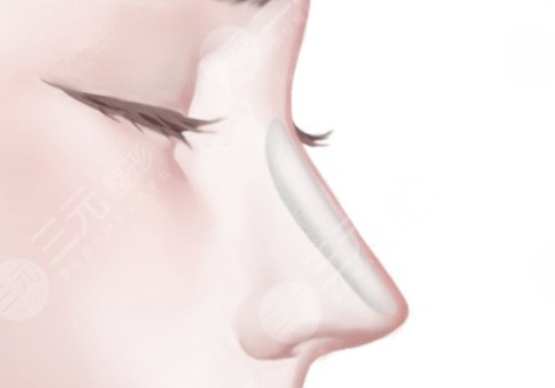 汕頭市中心醫(yī)院假體隆鼻價(jià)格