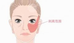 小拉皮手術(shù)切口在哪里？除皺提升指南，術(shù)前科普帶你掃盲！