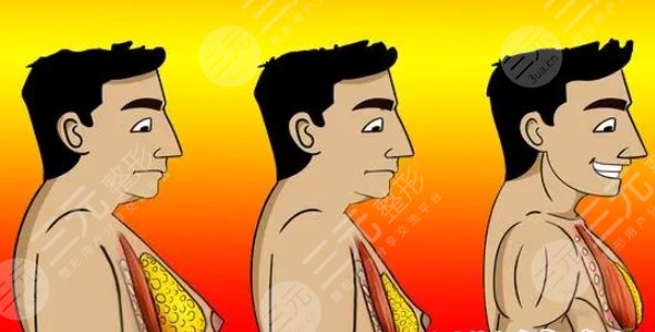 男生胸部肥肉怎么減01.jpg