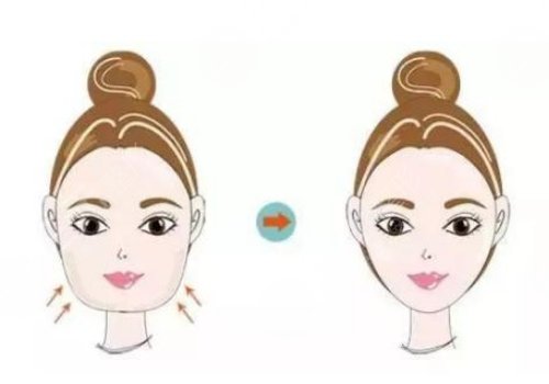 佛山華美整形美容醫(yī)院瘦臉怎么樣