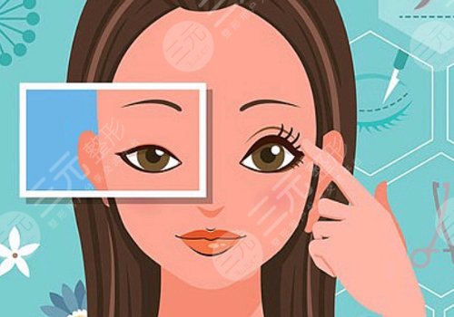 佛山曙光金子醫(yī)學美容醫(yī)院雙眼皮怎么樣