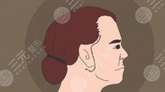 全新拉皮手術(shù)技術(shù)是哪種？面部除皺指南，術(shù)前這些要了解！