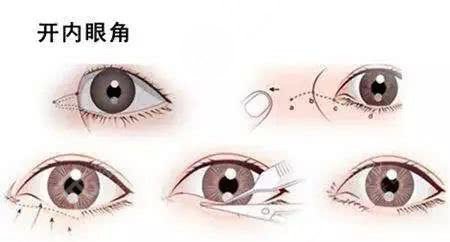 上海九院王業(yè)飛醫(yī)生怎么掛號