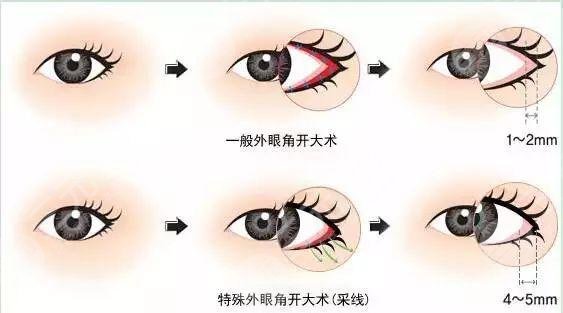 上海九院王業(yè)飛醫(yī)生怎么掛號