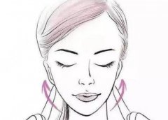 做完拉皮手術(shù)12天圖片講解！手術(shù)原理，術(shù)前術(shù)后常識科普~