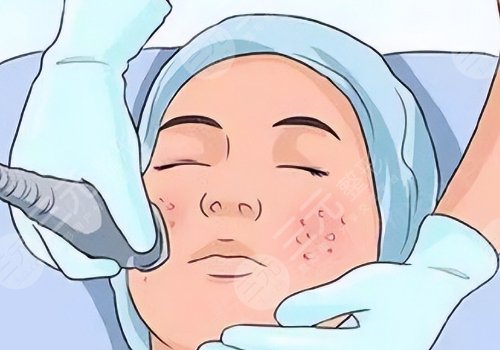 佛山市第二人民醫(yī)院醫(yī)學(xué)美容科鼻整形專家