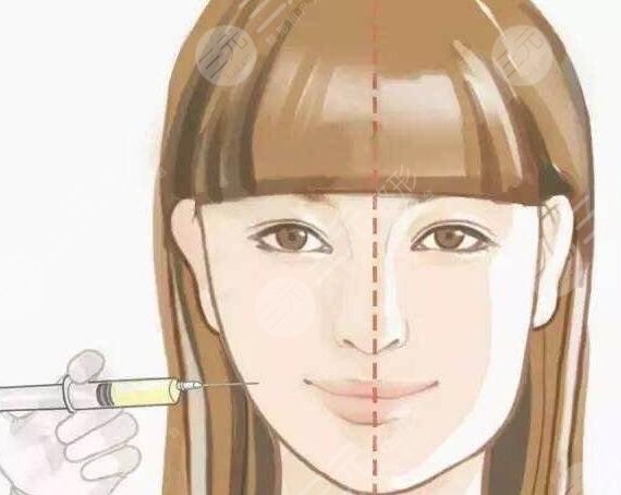 注射瘦臉