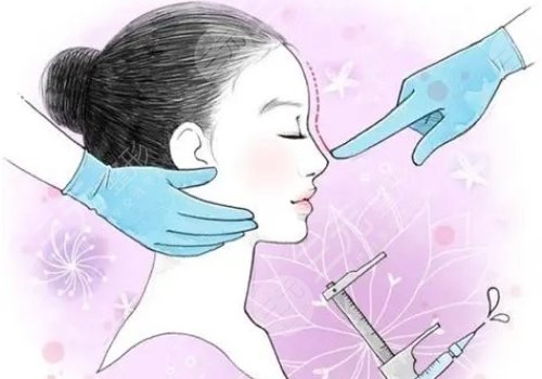 黎詠璇雙眼皮案例