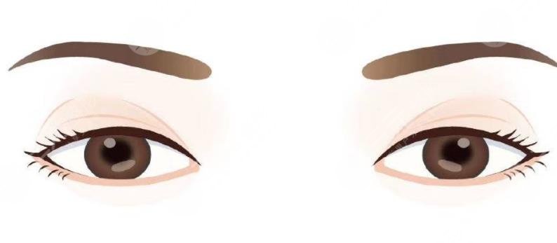 全切雙眼皮