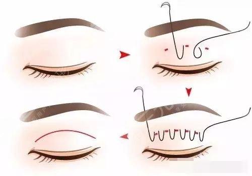 溫州醫(yī)科大學(xué)附屬第二醫(yī)院整形外科