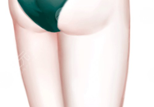 吸脂瘦大腿一般多少錢