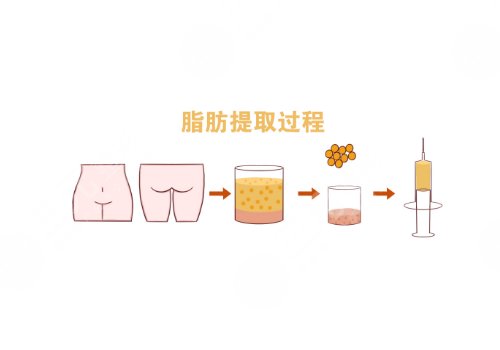 做一次醫(yī)美大概多少錢(qián)