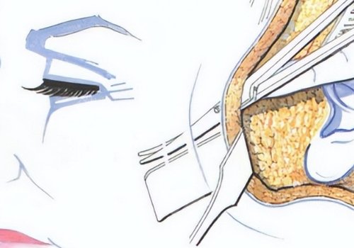 面部下垂好的醫(yī)美手段