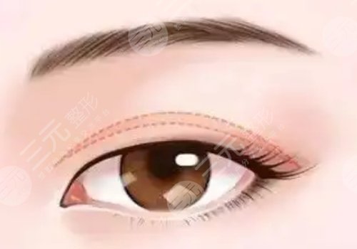 馬志兵醫(yī)生有沒有做過皮膚美容縫合