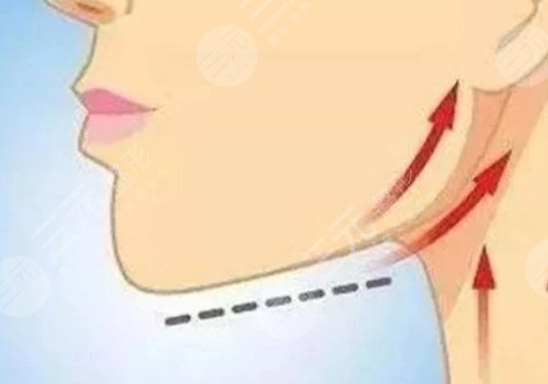 輪廓固定能維持多久