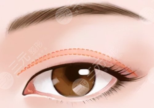 孔偉立雙眼皮怎樣