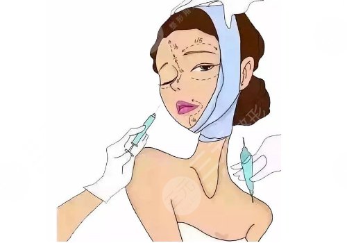 什么是輪廓固定抗衰