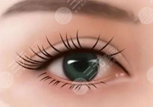 雙眼皮修復(fù)時(shí)間是什么時(shí)候