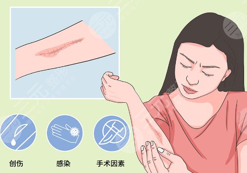 蘇州附二院祛疤怎么樣