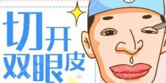 開(kāi)扇和平扇雙眼皮的區(qū)別對(duì)比！割雙眼皮術(shù)前需要知道的事~