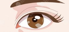 兩邊雙眼皮不對稱怎么辦？眼修復指南，打造魅力眼型！