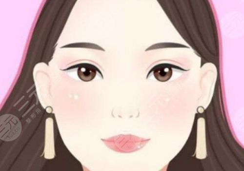 恢復快的雙眼皮做法是什么