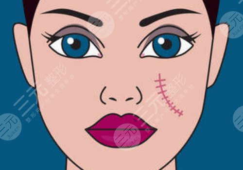 蘇州附二院祛疤多少錢(qián)