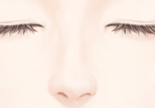 高順福,鼻整形手術(shù),費用