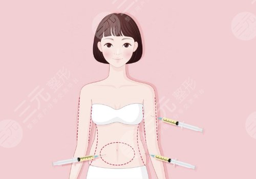 吸脂腰腹部需要休息幾天