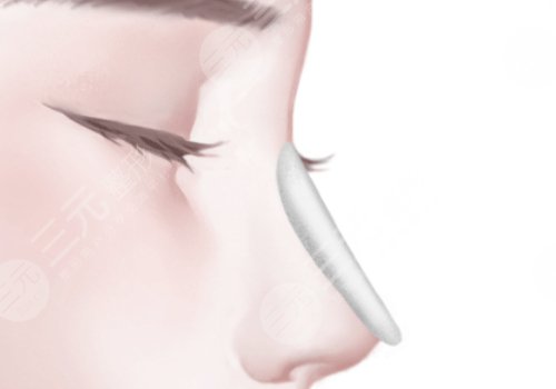 梁進(jìn)華做鼻子怎么樣