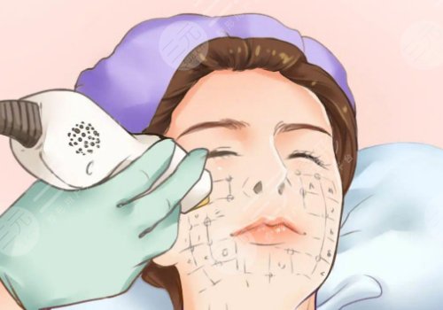 輕醫(yī)美有風(fēng)險嗎