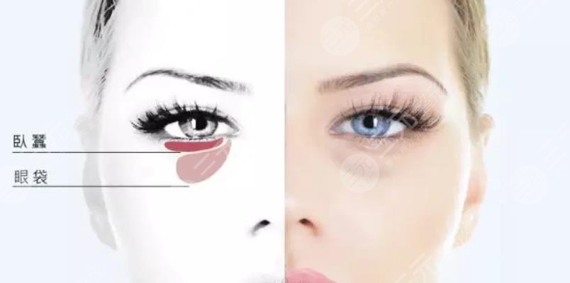 金華地區(qū)祛眼袋價(jià)格明細(xì)表