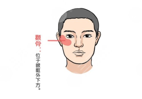 顴骨高怎么整容