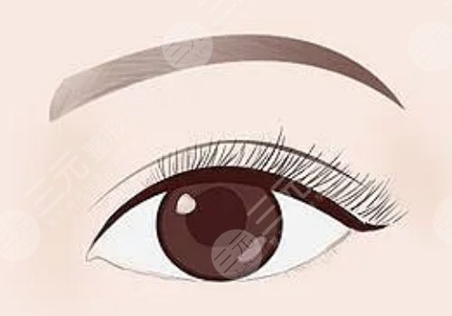 馬希達和趙穆欣誰做雙眼皮好