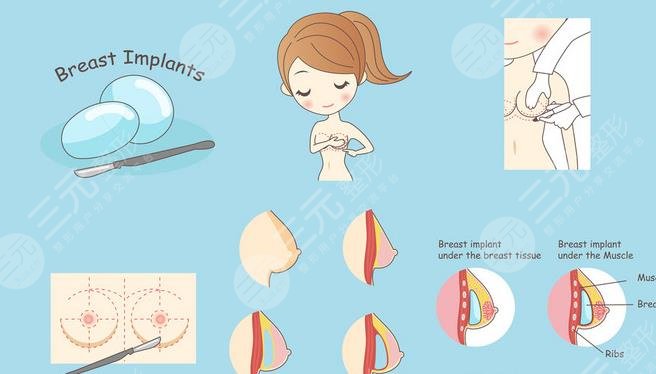 南京婦幼保健院隆胸手術(shù)多少錢?