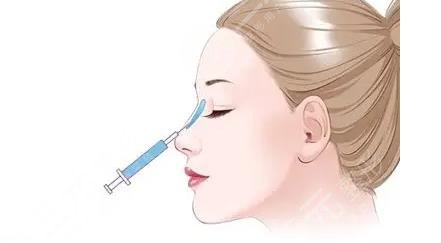 杭州第一人民醫(yī)院整形科鼻子修復怎么樣