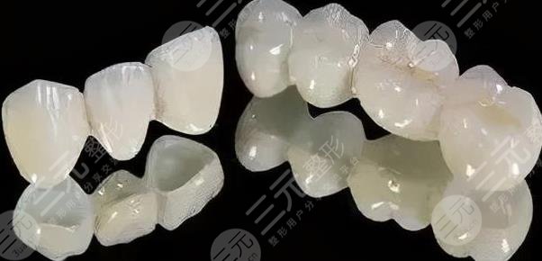 北京協(xié)和醫(yī)院種牙烤瓷牙能用多久