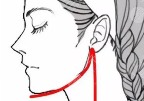 左右下頜骨不對(duì)稱(chēng)怎么矯正