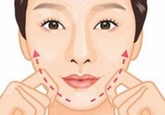 下頜角手術(shù)后遺癥是什么？不對(duì)稱、腫脹、感染等！術(shù)前必看