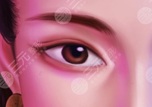 雙眼皮的修復(fù)手術(shù)的價(jià)格是多少