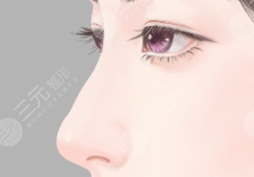 做個肋骨鼻大概多少錢