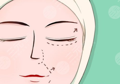 廣州大拉皮手術好的醫(yī)院排名