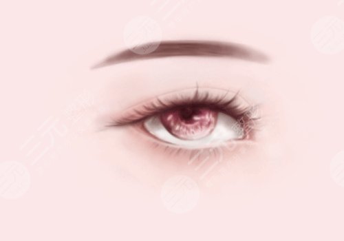 雙眼皮凹陷了怎么補救