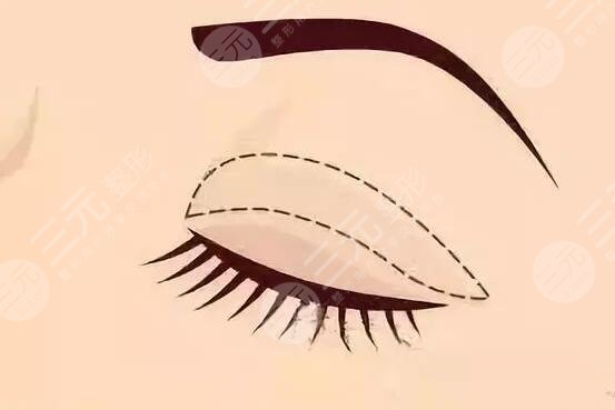 重慶第四人民醫(yī)院整形科簡(jiǎn)介