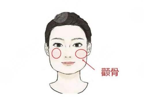 顴骨內(nèi)推怎么做