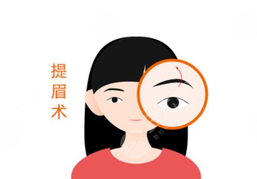 成都友誼整形美容醫(yī)院做提眉做的好的醫(yī)生