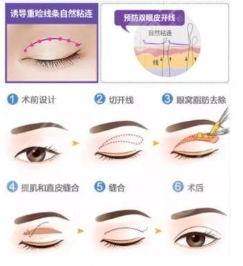 王太玲醫(yī)生擅長(zhǎng)項(xiàng)目